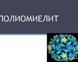 Полиомиелит